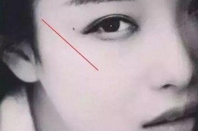 有泪痣明星,命运之痣下的璀璨星光